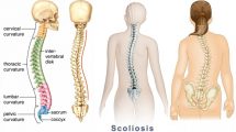 درباره بیماری اسکولیوز چه می دانید