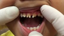 عوامل موثر در آسیب دیدن دندان ها