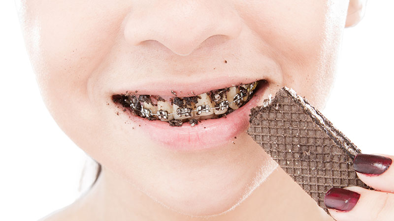 کدام یک از مواد غذایی و تنقلات بیشترین ضرر را به دندان ها می زنند ؟