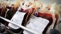 اهدای خون چه عوارضی دارد