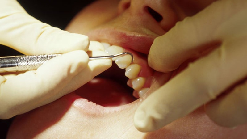 درباره درمان پوسیدگی دندان چه می دانید