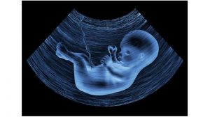 آخرین سونوگرافی در بارداری