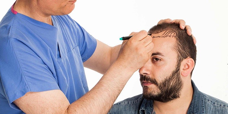 انجام آزمایشات قبل از عمل